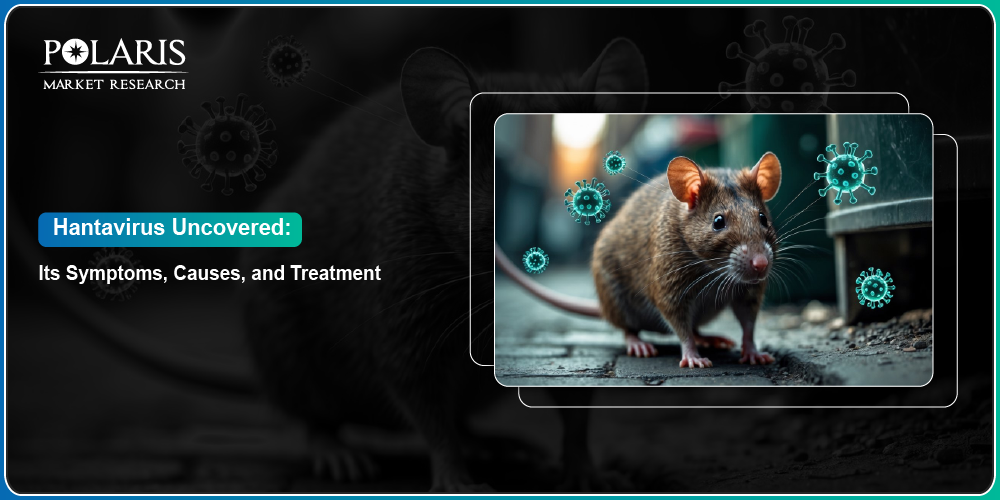 Hantavirus Uncovered: Its Symptoms, Causes, and Treatment
